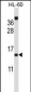 ROBLD3 Antibody (Center)